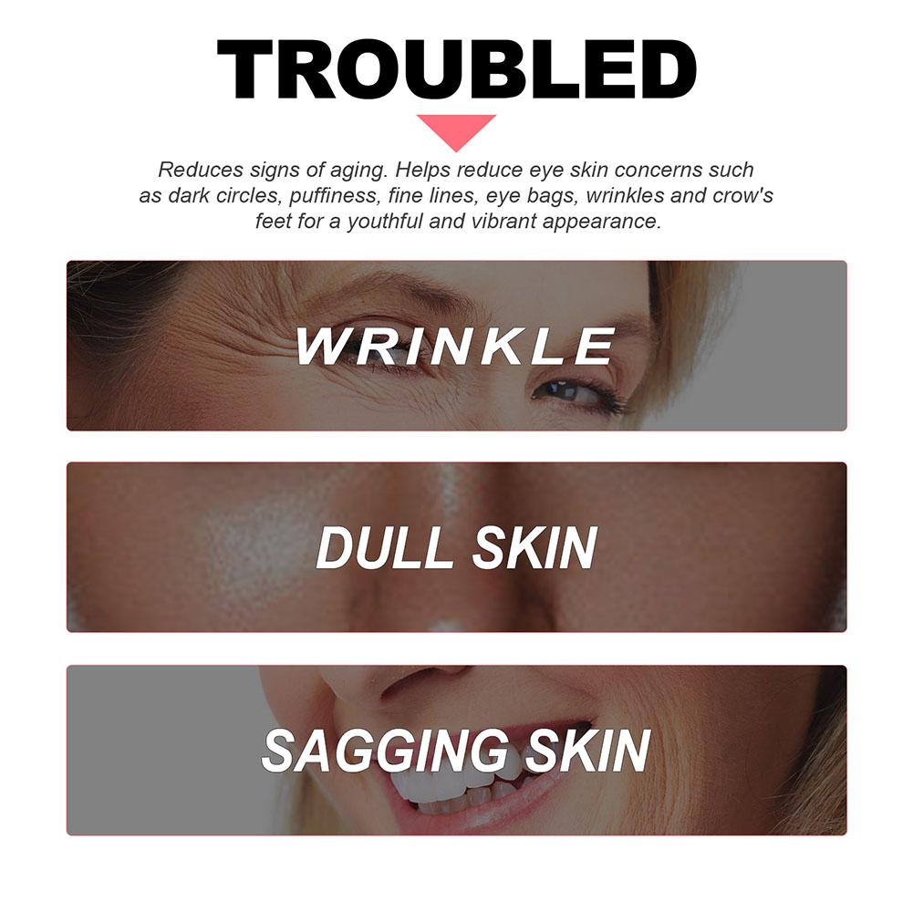 ครีมบำรุงรอบดวงตาเรตินอล ลดรอย - The Ordinary Serum Hyaluronic Acid บทวิจารณ์และราคา